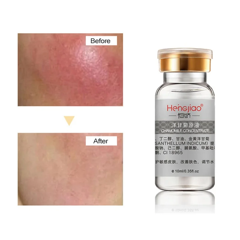 Горячий экстракт ромашки питание восстановление увлажняющий крем против