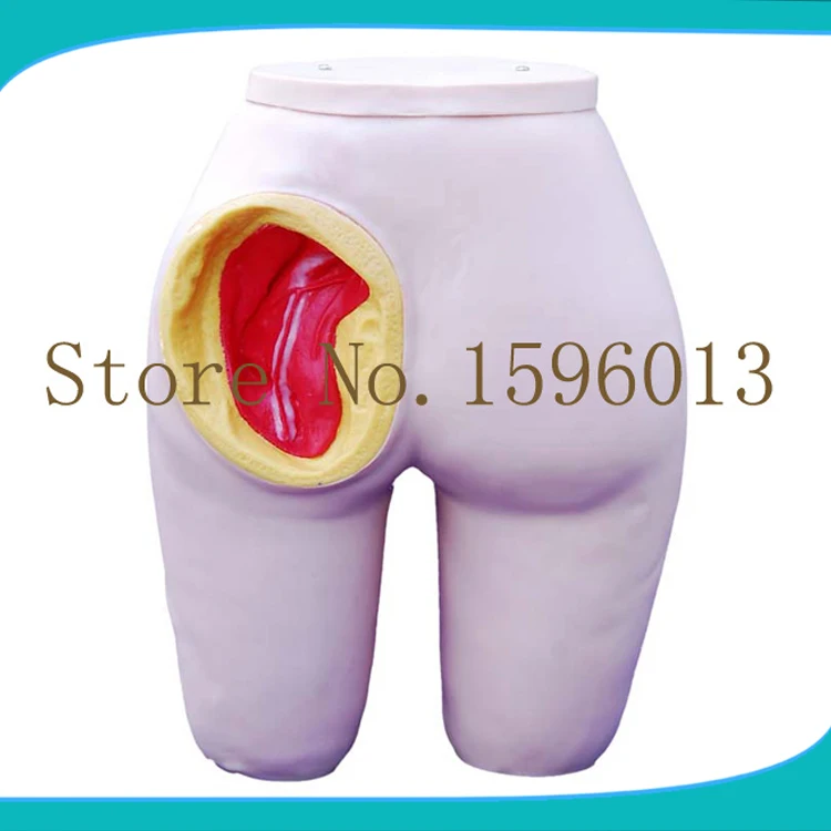 

Advanced Buttocks Intramuscular Injection Training Model, Hip injection simulator