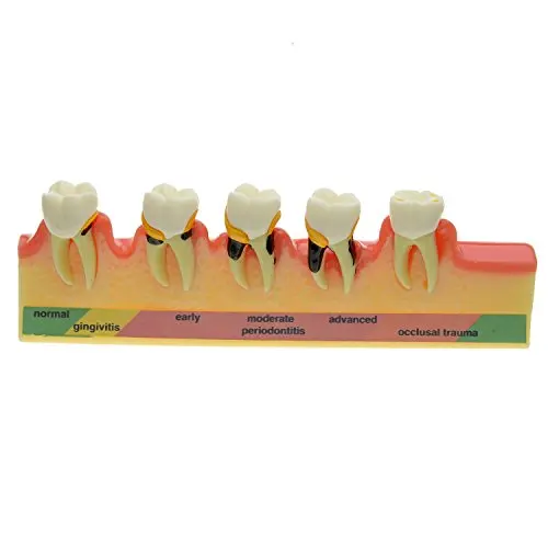 Высокое качество Новое поступление стоматологический периодонтальный болезни