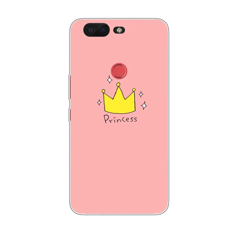 Infinix Zero 5 X603 Case Silicon Painted animals Painting Soft TPU Back Cover for protect Phone cases shell |