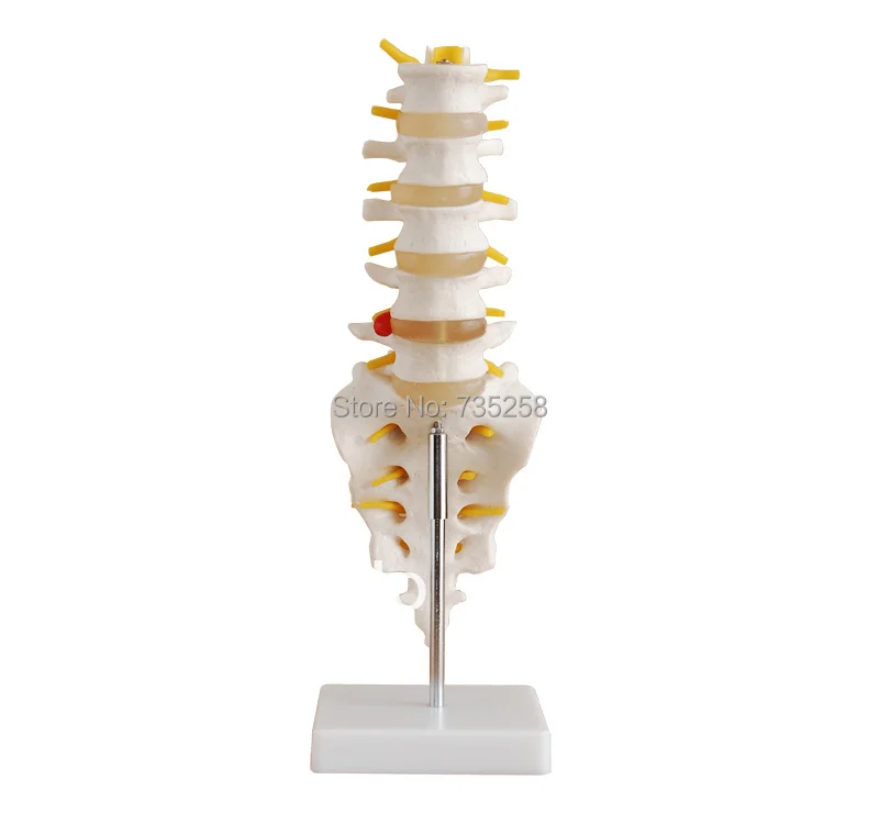 

Life-Size Lumbar Vertebrae with Sacrum & Coccyx and Herniated Disc model