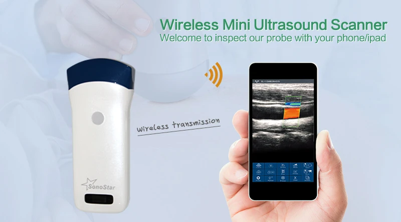 Convex Series(Convex & Linear) Wireless Probe Type Ultrasound Scanner acaner ultrasonido