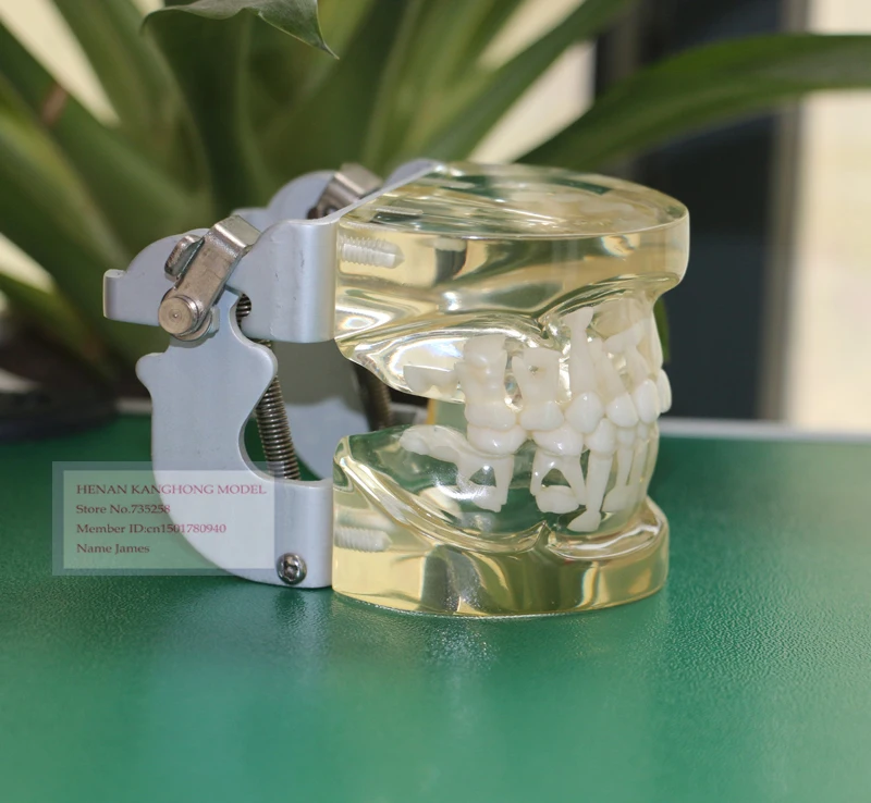 Transparent Milk Teeth Alternating Model,Children's Teeth Growth Model,Model 5 to 9 Years Old Children's Teeth