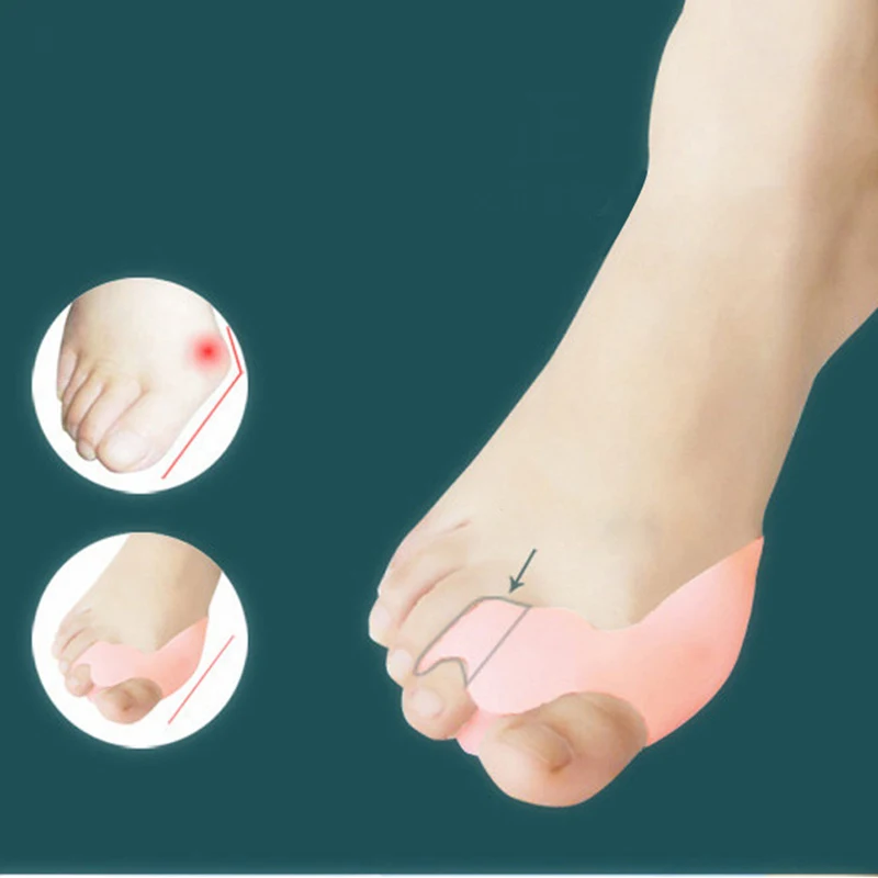 2 шт. силиконовые разделители для пальцев ног|foot care tool|care toolbunion splint |