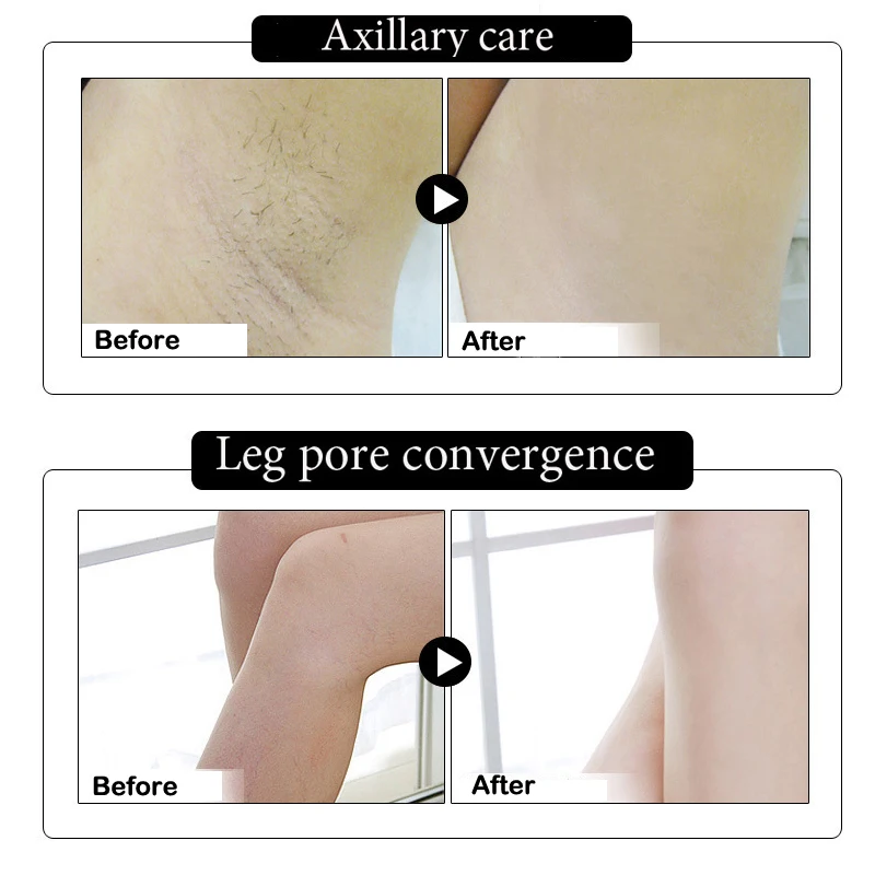 Отбеливающее мыло для подмышек Aichun Отбеливание подмышки крем ног коленей