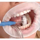Бесплатная доставка, 10 шт., одноразовая Стоматологическая резиновая Стерильная открывалка для рта, Ретрактор для полости рта расширители щеки