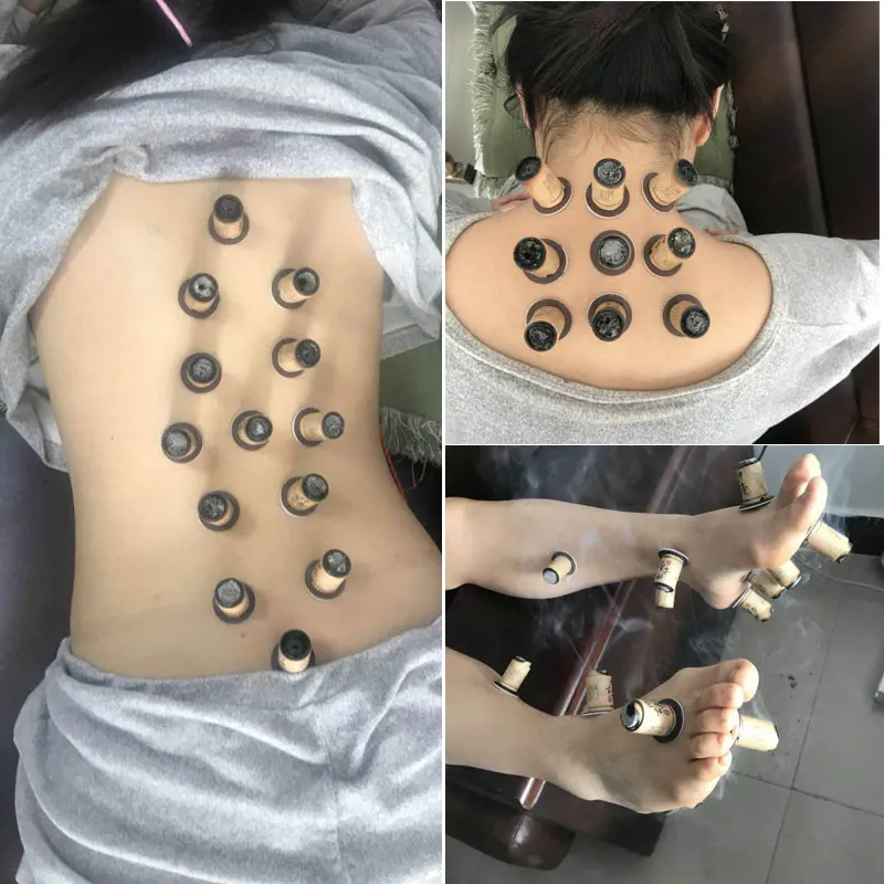 

SHARE HO 30pcs Moxa Artemisia Tube Self-stick Chinese Moxibustion Stickers Therapy Heating Acupuntura Point Warm Meridian