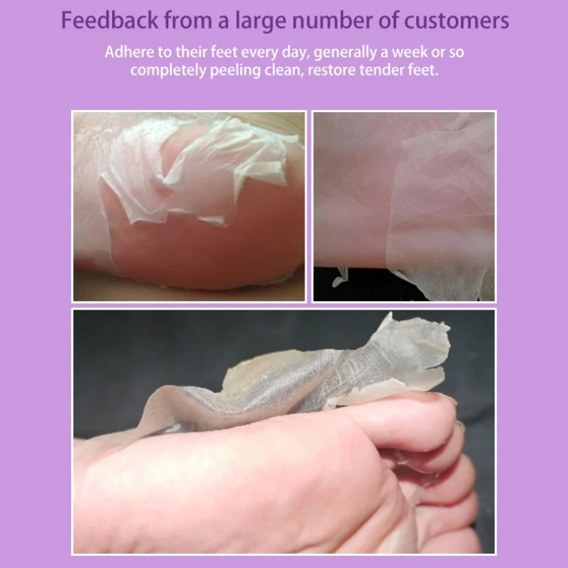 Имбирная Лаванда питающая маска для ног отшелушивающая настоящая педикюра