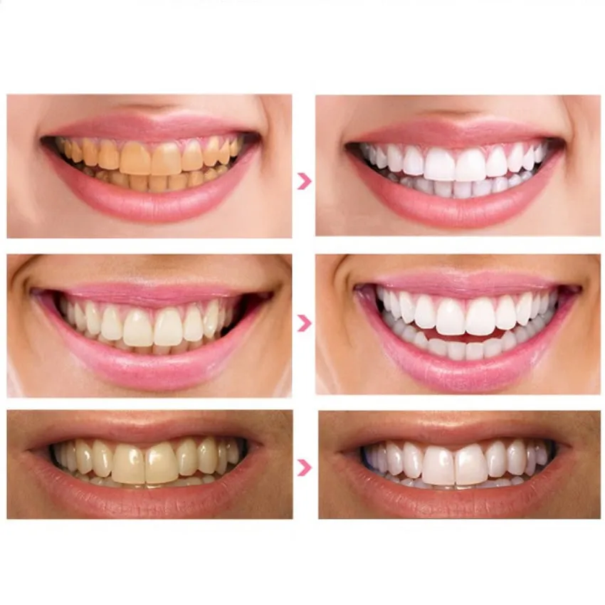 3 пары/партия 3D отбеливающий гель полоски Ярко белая Dental лечения набор для