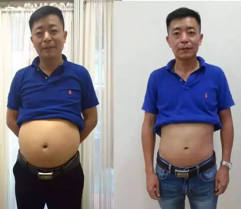 Пластырь для похудения пластырь похудения|weight loss patch|slim patchparches adelgazantes |