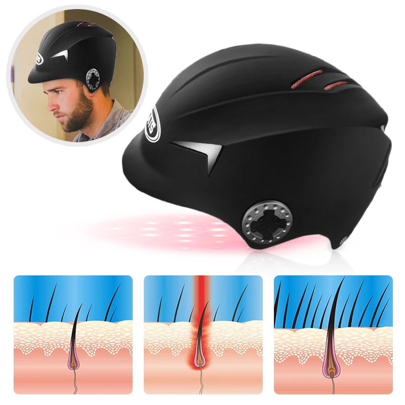 Мужская кепка для роста волос лазерный шлем 64/128 выпадения лечения мужчин