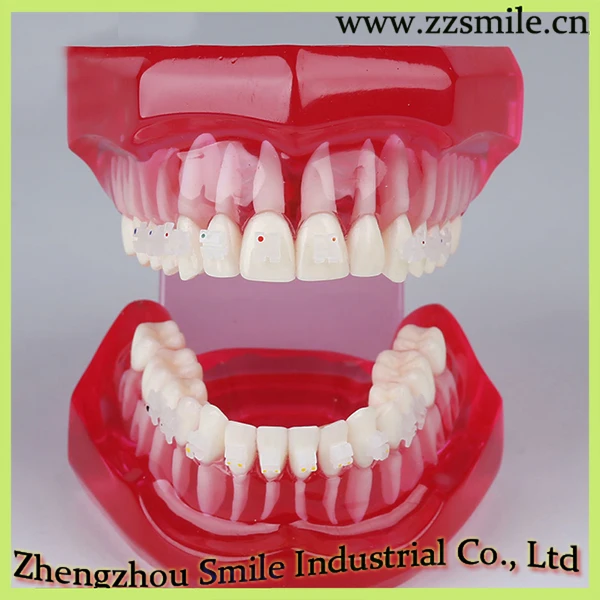 Фотообои с фонариком M3002|dental model study|model dentaldental orthodontics |