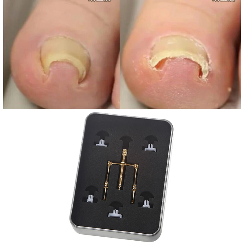 Обновленная версия искусственные ногти из чистой меди инструмент для ухода за