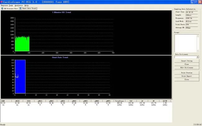 CONTEC8000G Многофункциональный ПК ECG/EKG рабочая станция система 12 свинец отдыха ECG