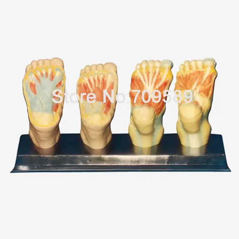 

ISO Plantar Dissection Model, Anatomical Foot Model