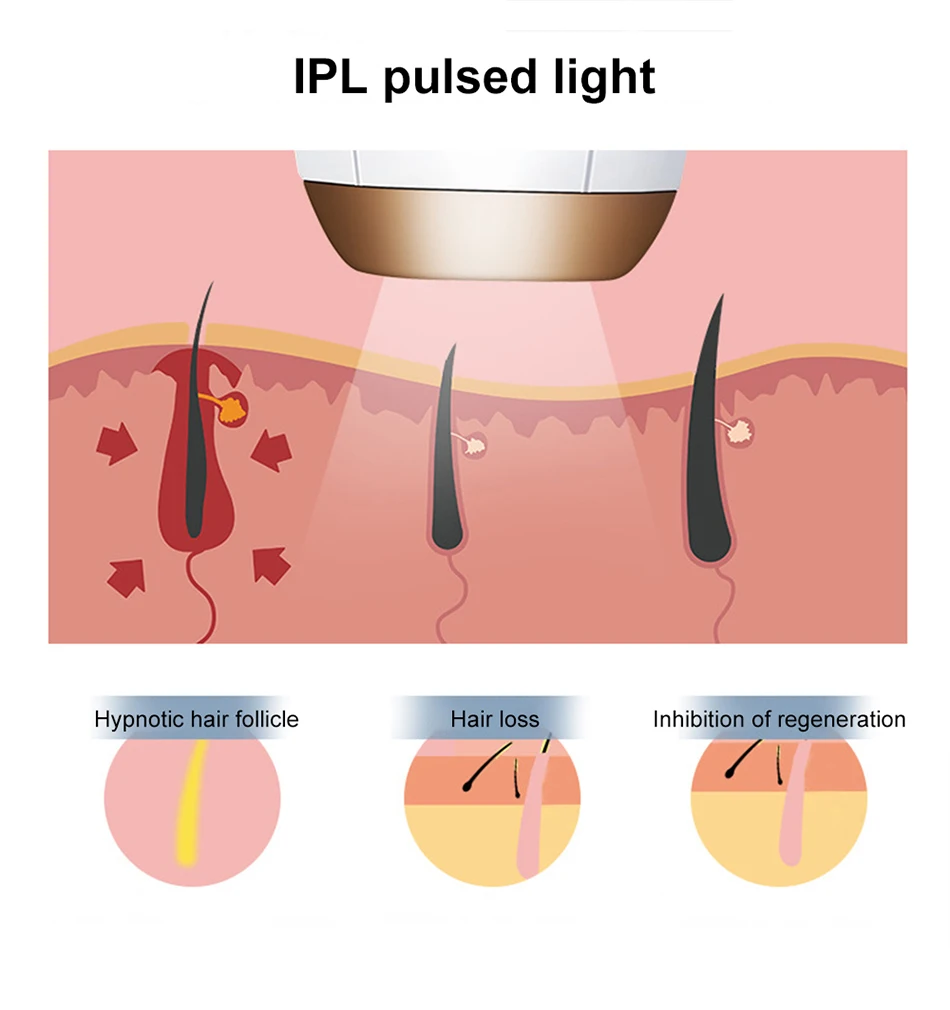 Перманентное Удаление волос IPL лазер 500000 Эпилятор весь лазер для удаления волос устройство для женщин мужской бикини Эпилятор для подмышек