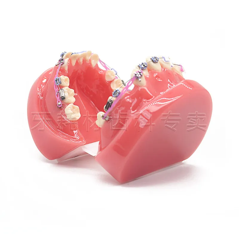 Новая Стоматологическая Ортодонтическая лечебная модель для прикуса с