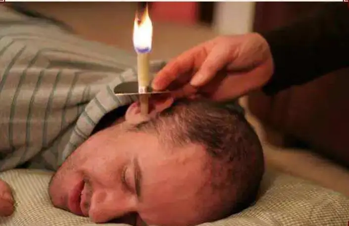 100 шт./компл. беруши со свечами для удаления ушей лечение здоровья полый конус