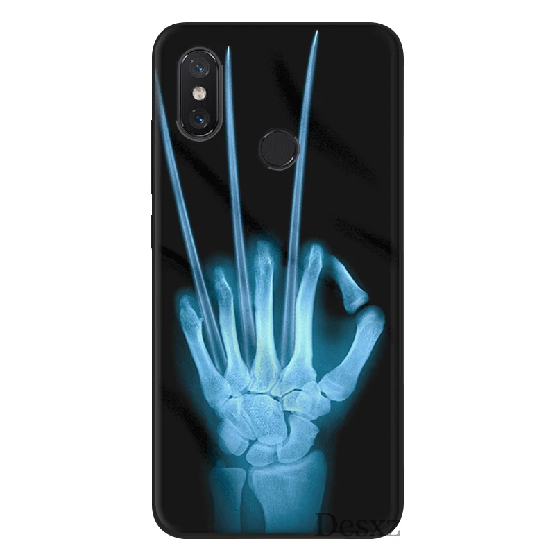 Desxz силиконовый чехол для мобильного телефона Xiaomi Redmi GO 7 S2 4A 4X5 5A Plus 6 6A Pro Чехол Росомаха X-ray рука кости сумка оболочка