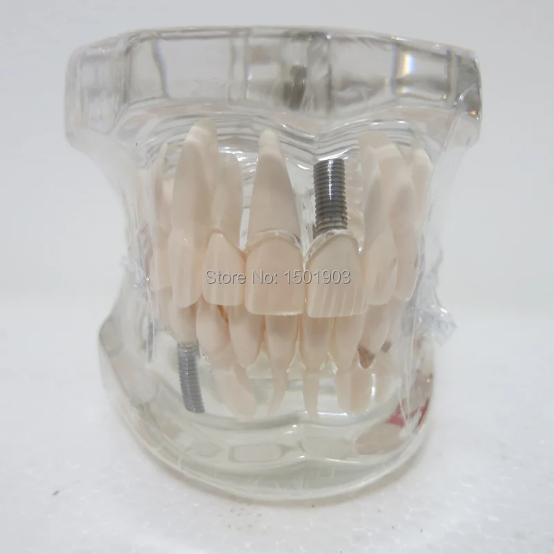 

Dental materials denture model Oral removable dental pathological model Tooth Study Teach Model