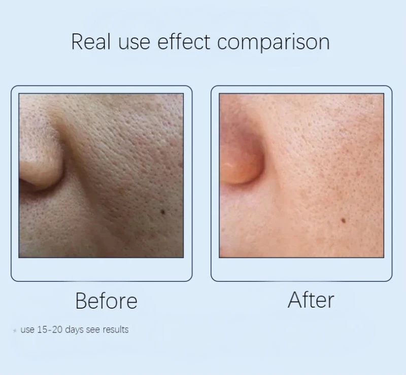 Dimollaure Fullerene 24K Золотая сыворотка, сыворотка с койевой кислотой, витамин С, сыворотка с гиалуроновой кислотой, сыворотка против старения, увлажняющая, отбеливающая