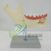 human mandibular anatomical model maxillary nerve oral anatomy teaching model free shipping