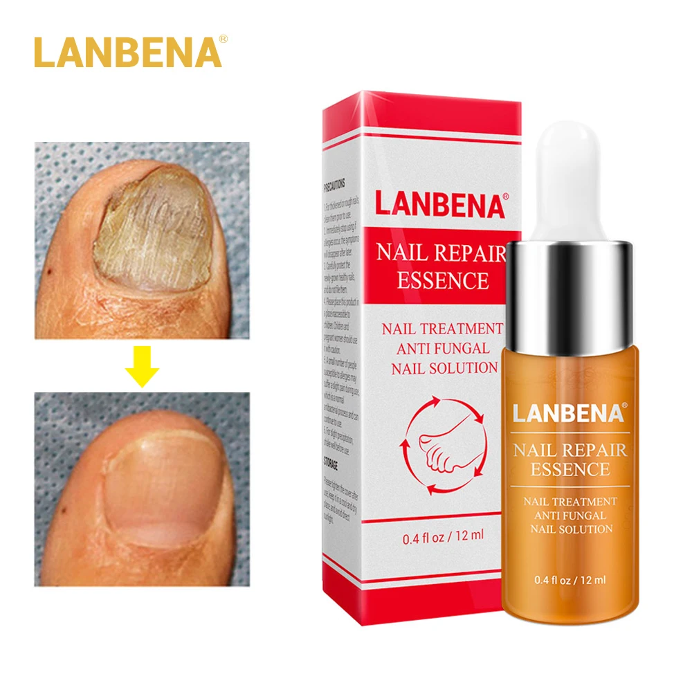 LANBENA онихомикоз для восстановления ногтей эссенция Сыворотка лечения грибка ног