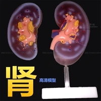 medical kidney anatomy model of human medicine kidney ball section of teaching and training of special ureteral function