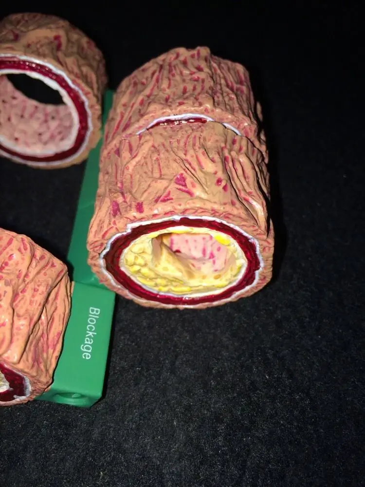 Человеческий череп анатомический скелет позвоночник 4 части артерии