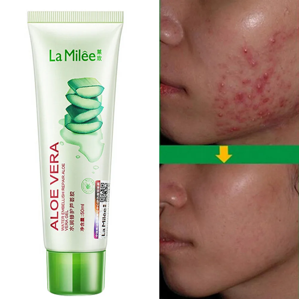 Новинка 2018 эффективный крем для ухода за кожей лица удаления акне пятна шрам