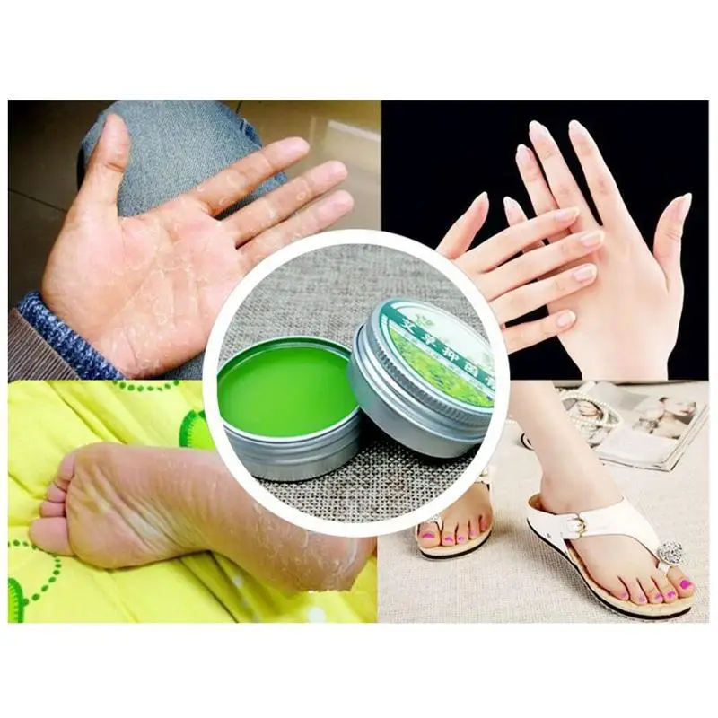 1bottle Herbal Moxa Essential Cream Itching Moxibustion Oil Massage Ai Cao Antibacterial Ointment Anti-mosquito Bite |