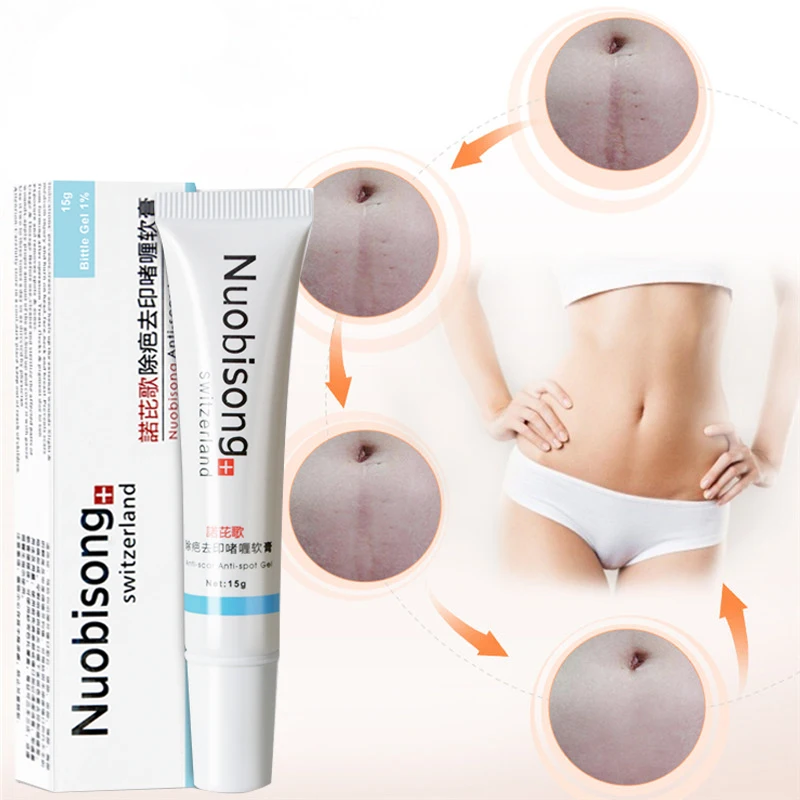 

1pc Nuobisong facial scar removal Striae Gravidarum Pigmentation Corrector Anti-Aging cremas face Spots treatment stretch marks