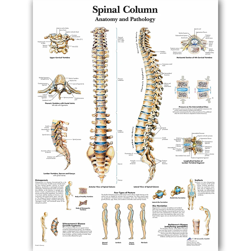 WANGART постер с изображением спинномозговой колонны Картина на холсте настенные