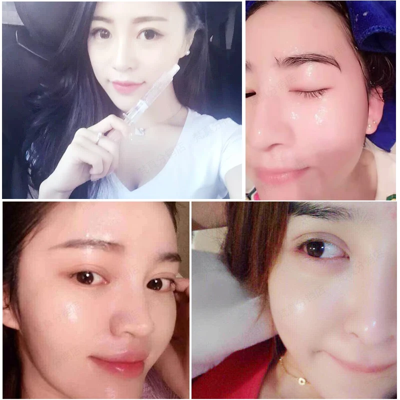 Pure acido hyaluronic acid liquid 10ml moisturizing oil lock the bride ampoules Face Care | Красота и здоровье