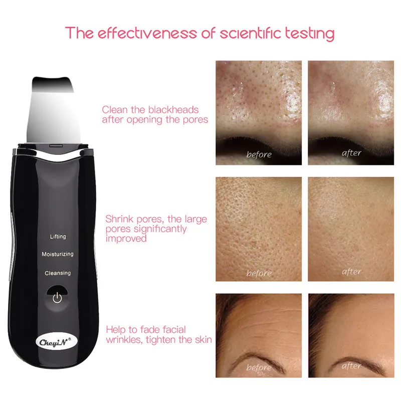 Ultrasonic Facial Skin Scrubber Face Deep Cleaning Blackhead Port Dirt Wrinkles Removal Lifting Firming Beauty Instrument Tool40 |