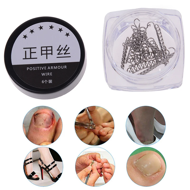 

12pcs Nail Art Ingrown Toenails Correction Wire Recover Care Paronychia File Patch Corrector Foot Pedicure Tool