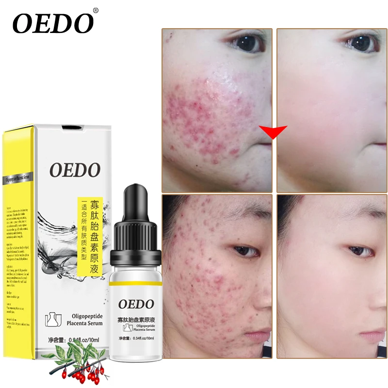 Средство для ухода за кожей лица против морщин|Сыворотка| |