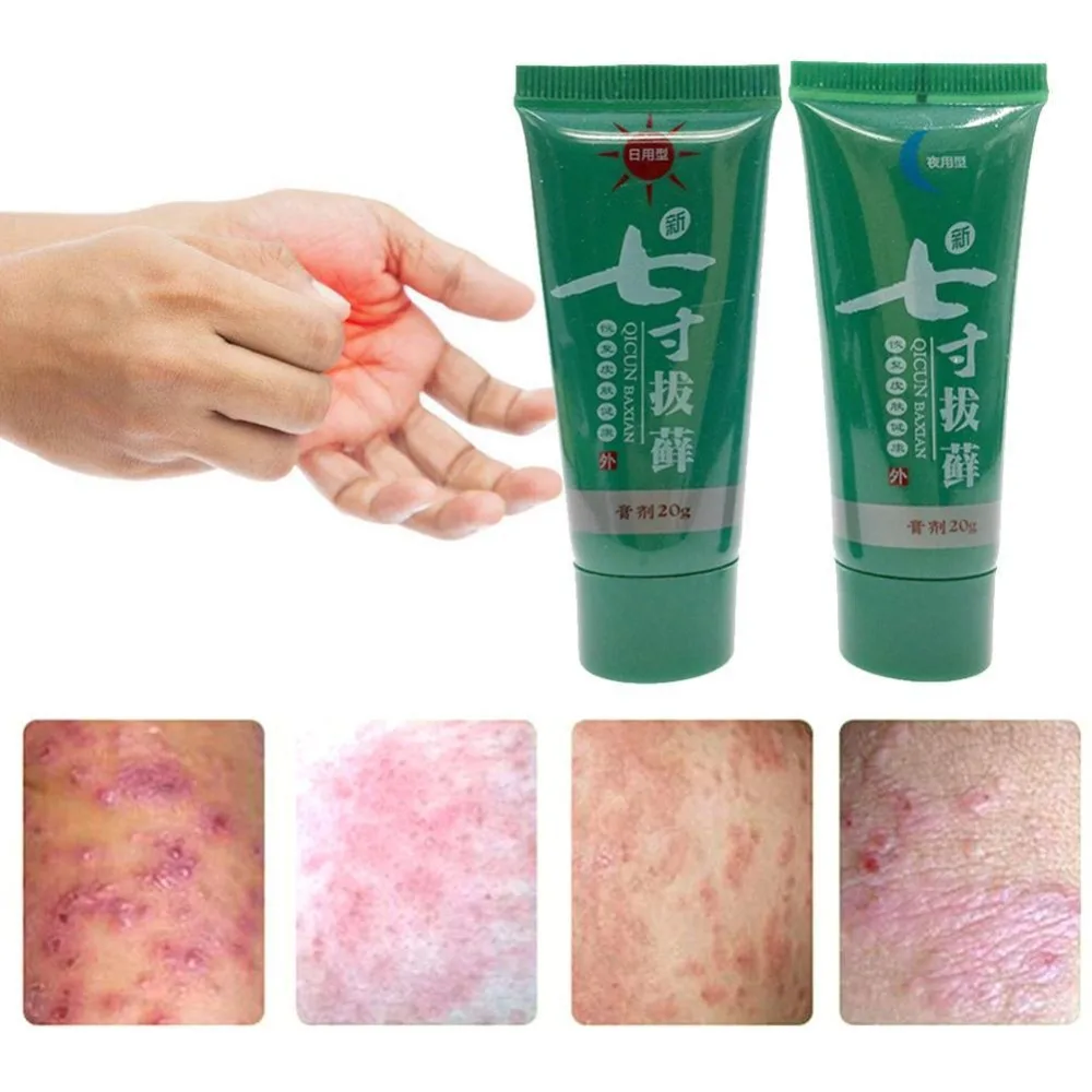 

1 Set Day & Night Body Psoriasis Cream Dermatitis Eczematoid Eczema Ointment Skin Psoriasis Treatment for Eczema Anti-Serpedo