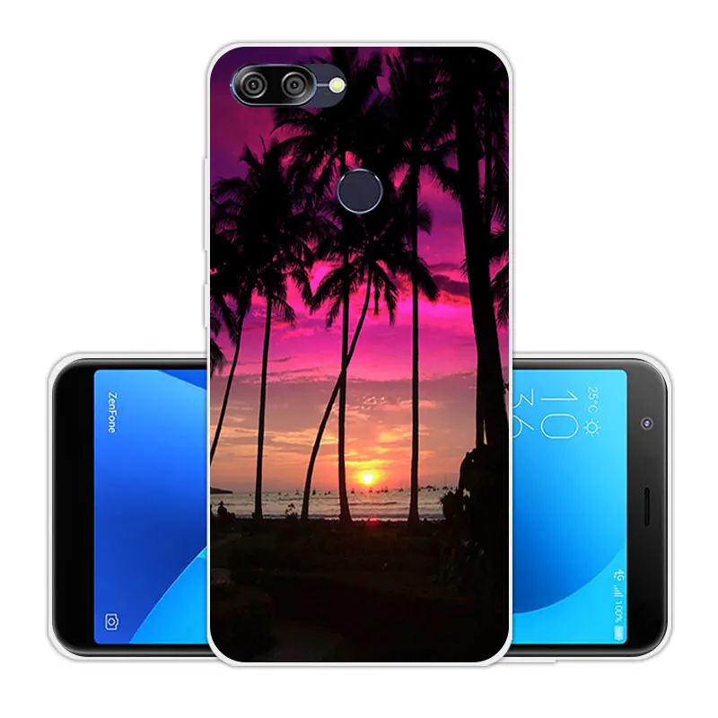 5.7 inch For Asus Zenfone Max Plus(M1) X018DC ZB570TL Soft Transparent Silicone DIY Skuli Back Cover Coque Pegasus 4S |