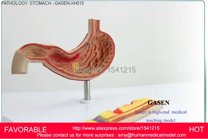 Анатомическая модель желудка анатомия анатомии человека желудочно кишечного