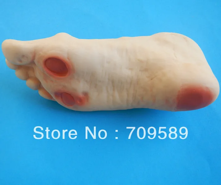 Усовершенствованная модель ног для диабетиков ухода за ногами|diabetic foot|carecare foot |