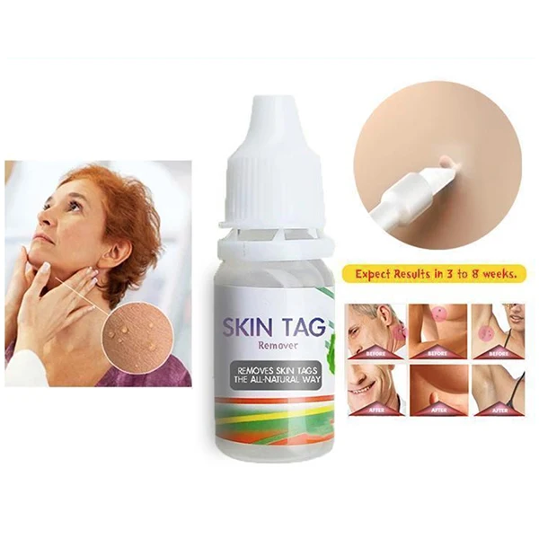 Скин для удаления этикеток медицинский Tu убить бирки кожи моль & женских половых