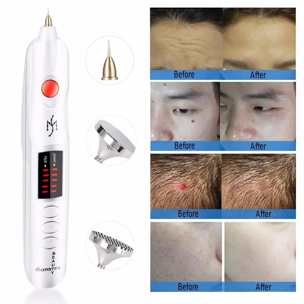 Косметический аппарат Plasma Pen Plasma liner Beauty Monster