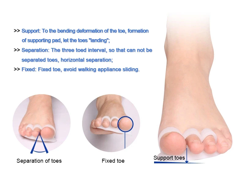 1 пара разделитель для костей при вальгусной деформации|toe separator|toes overlappinghallux valgus |