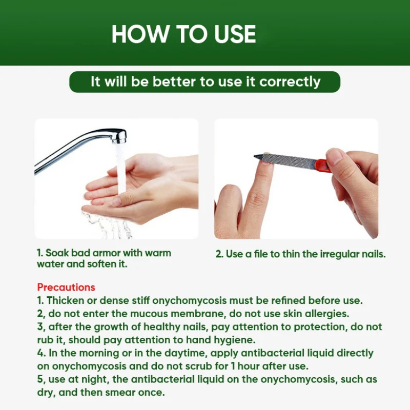 Травяной серый ноготь ★ крем Антибактериальное Жидкое Лечение грибка для пилки