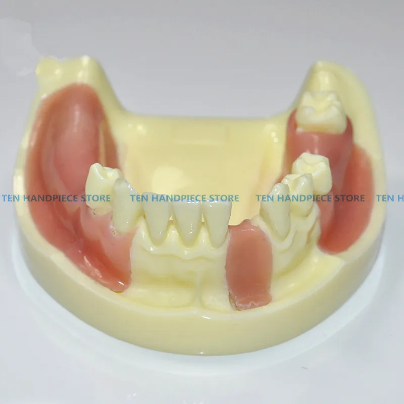 

2018 good quality Implant practice model for teaching dental tooth teeth dentist anatomical anatomy model odontologia
