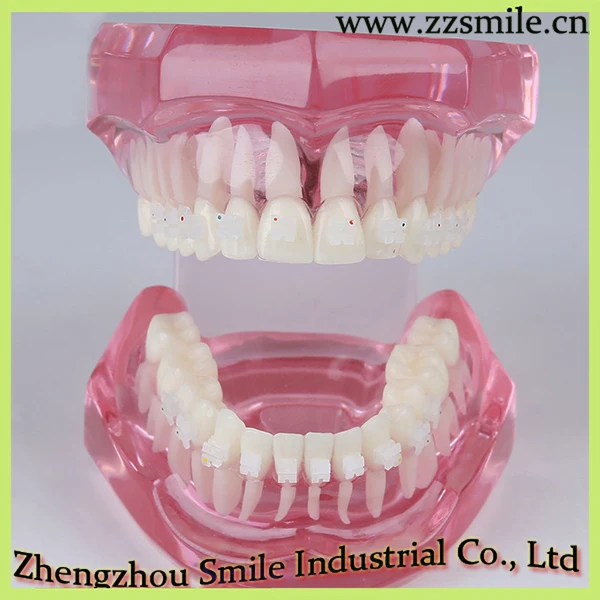 Фотообои с фонариком M3002|dental model study|model dentaldental orthodontics |