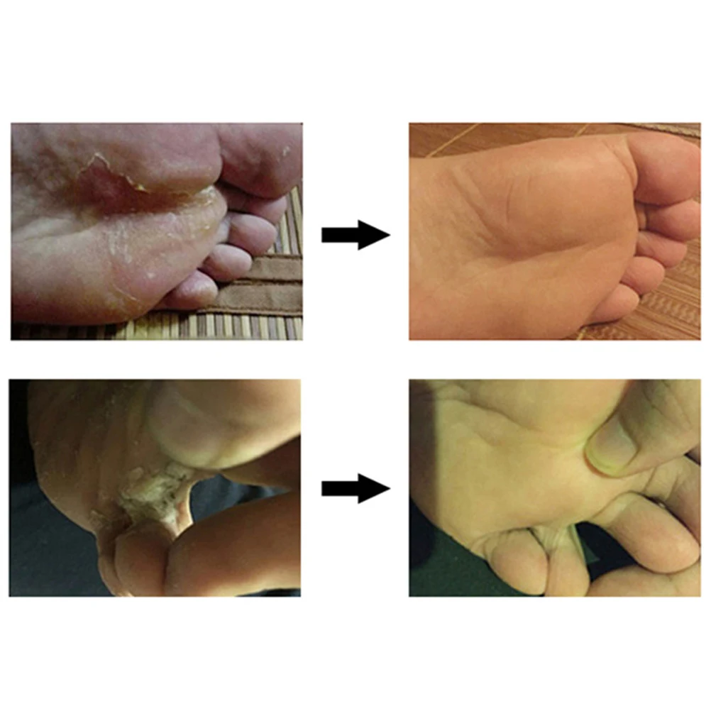 Конский масляный крем для ног 60 г крем для тела анти-износ кожи увлажняющий восстанавливающий крем грубая сухая трещина увлажняющий уход за руками и ногами