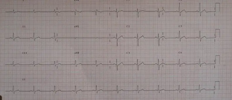 [manufacturer] ECG generator with a variety of abnormal simulator SKX-2000sup | Инструменты