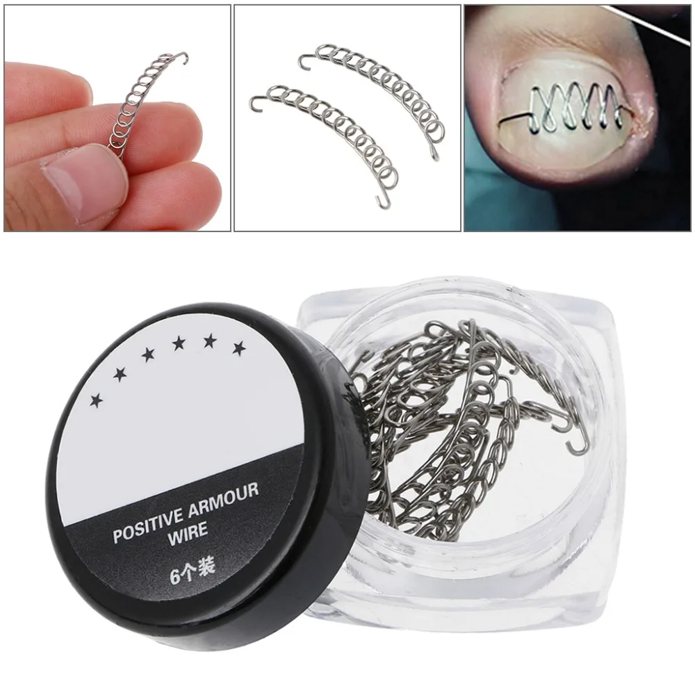 OOTDTY Stainless Steel Silver Ingrown Toe Nail Correction Pedicure Wire Fixer Paronychia Recover Tool Home | Красота и здоровье